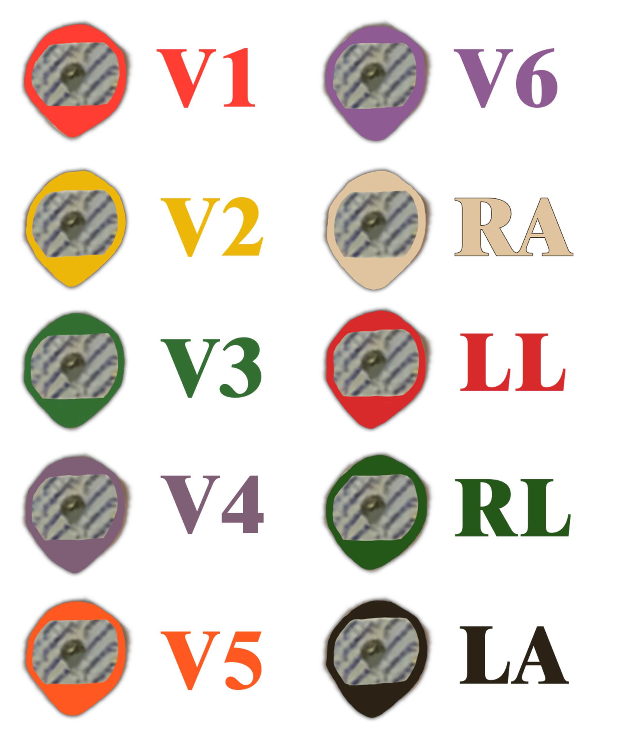 ECG