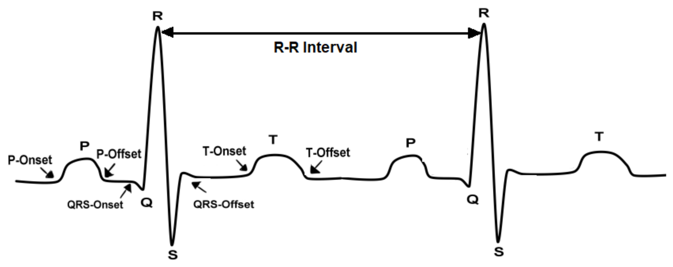 Power Line Noise