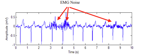 EMG Noise