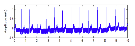 Power Line Noise