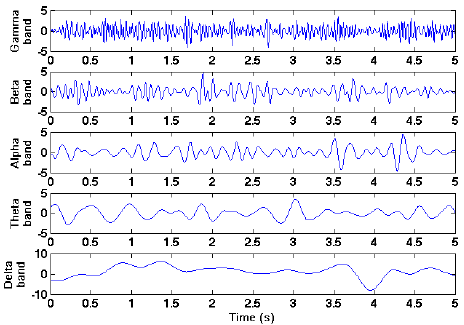 EEG