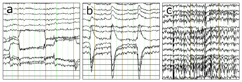 EEG