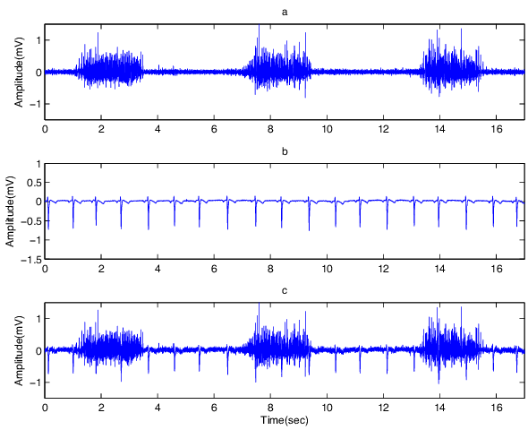 Baseline Noise