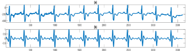 Power Line Noise